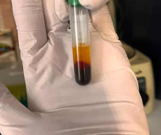 Veterinaria analizando muestra de sangre en el laboratorio de la clínica veterinaria El Jardín.